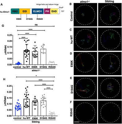 Functional Verification of Novel ELMO1 Variants by Live Imaging in Zebrafish